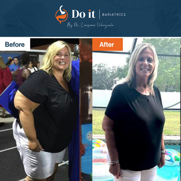 Slider image (5) Do It Bariatrics